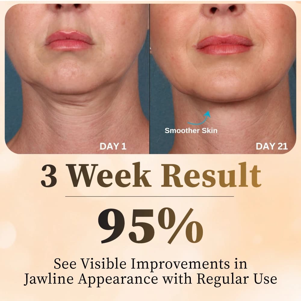 VIMINTO Face Massager Before After Results - Wrinkle Reduction in 3 Weeks